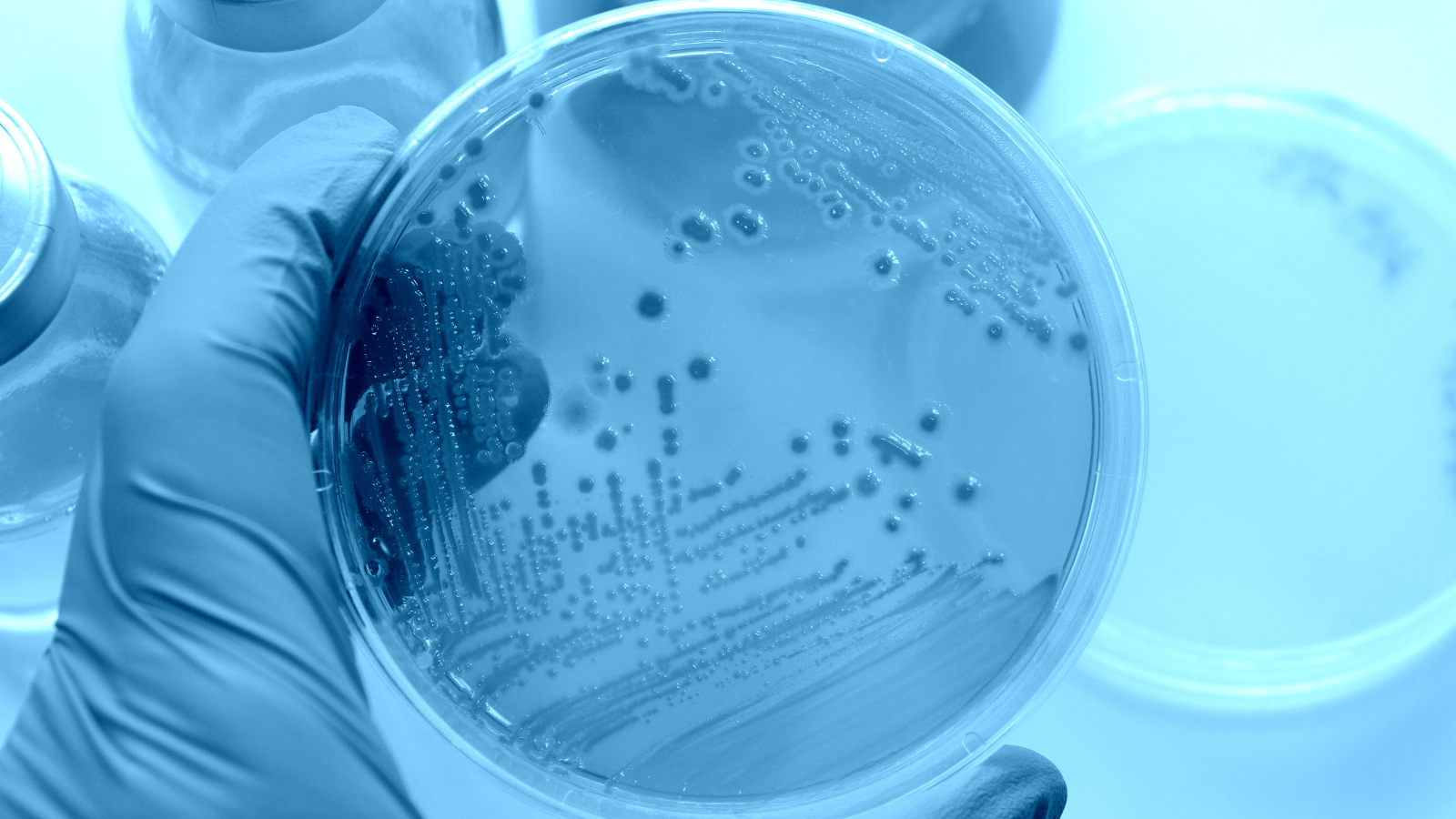 Microbiological Environmental Monitoring Map Construction: A pilot study